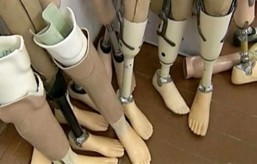 У Черкасах роблять безкоштовні протези для поранених