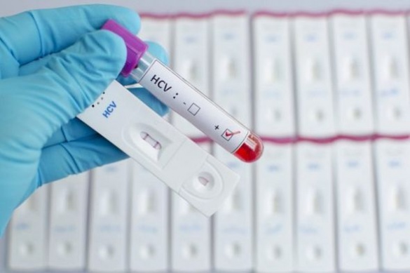 Черкащани зможуть пройти безкоштовне тестування на гепатит