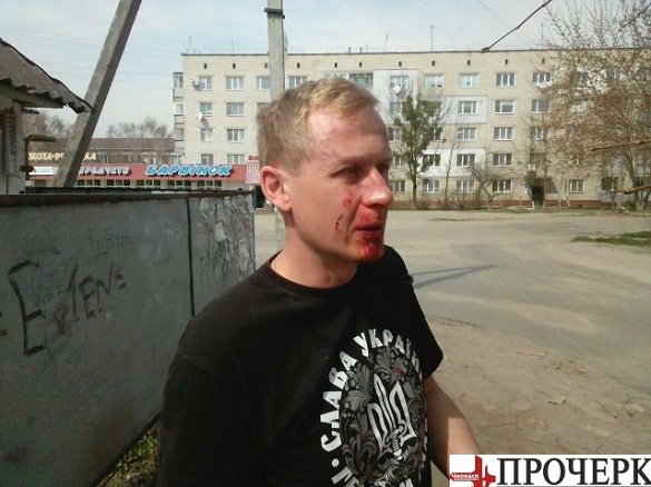 На Черкащині жорстоко побили активіста (ФОТО)