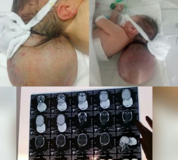 Покинуте напризволяще немовля, яке зараз у черкаській лікарні, терміново потребує допомоги
