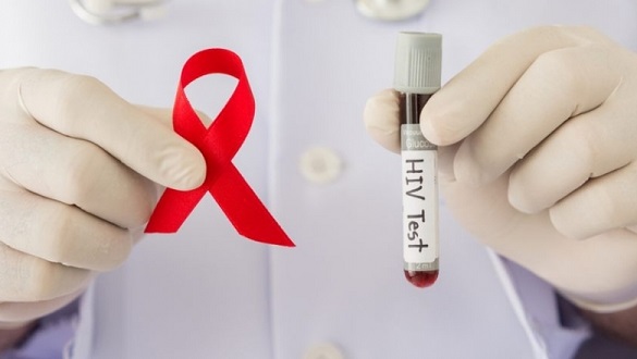 Черкащани зможуть безкоштовно перевіритися на ВІЛ та гепатит