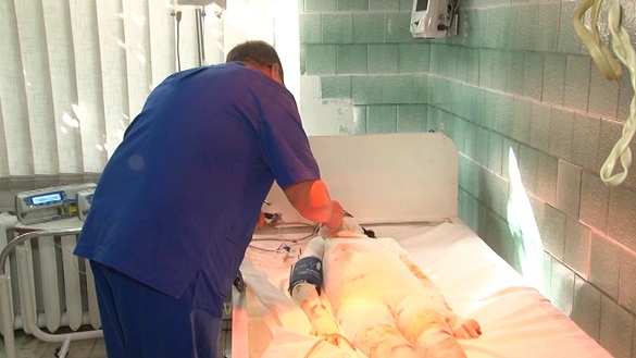 Дівчинка, яку вразило струмом, перебуває в черкаській лікарні у тяжкому стані