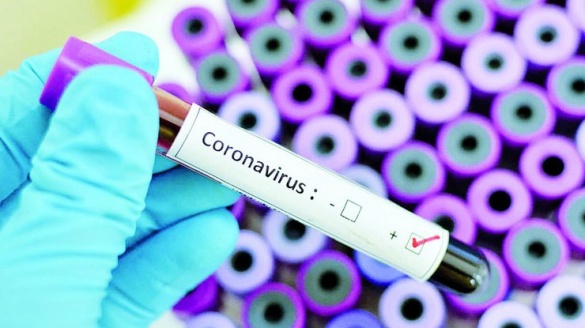 На Черкащині зафіксували третій випадок інфікування коронавірусом