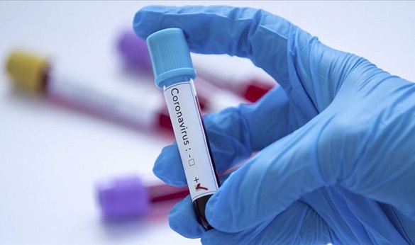 Ще два випадки інфікування на коронавірус зафіксували у Кам'янці
