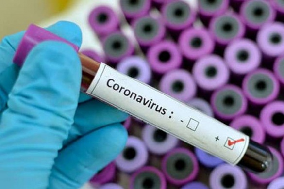 19 жителів Кам'янки одужують від коронавірусу