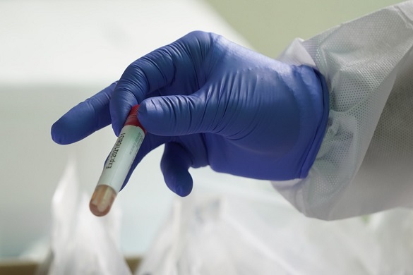 У Черкаській міській інфекційній лікарні перебуває 8 осіб із коронавірусом