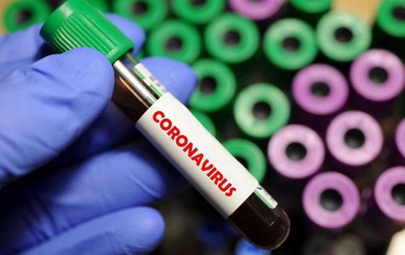 П'ять осіб на Черкащині захворіли на коронавірус за останню добу