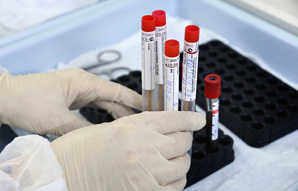 Десять нових випадків коронавірусної інфекції зафіксували на Черкащині