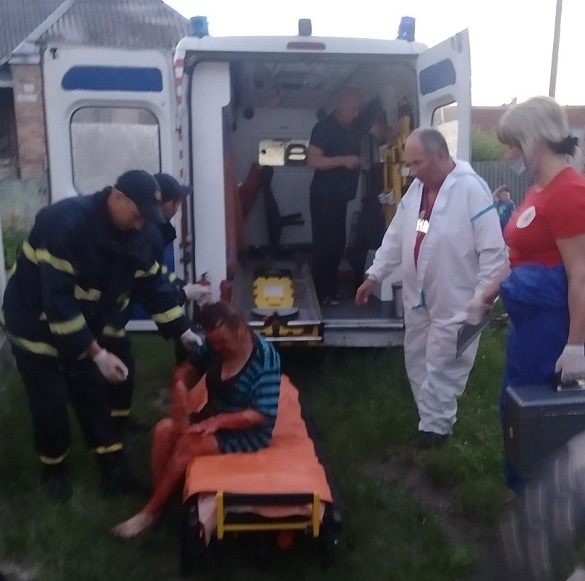 57-річна жінка на Черкащині впала до 5-метрового льоху