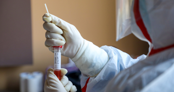 На Черкащині 13 осіб захворіло за добу коронавірусом