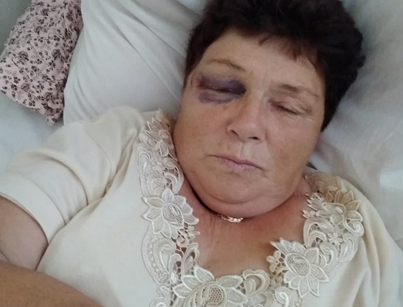 Жінку на Черкащині по-звірячому побив сусід (ФОТО)