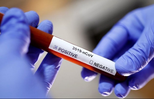 Шість осіб на Черкащині захворіло коронавірусом за добу