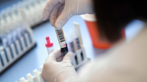 Десять нових хворих на коронавірус виявили в Черкаській області
