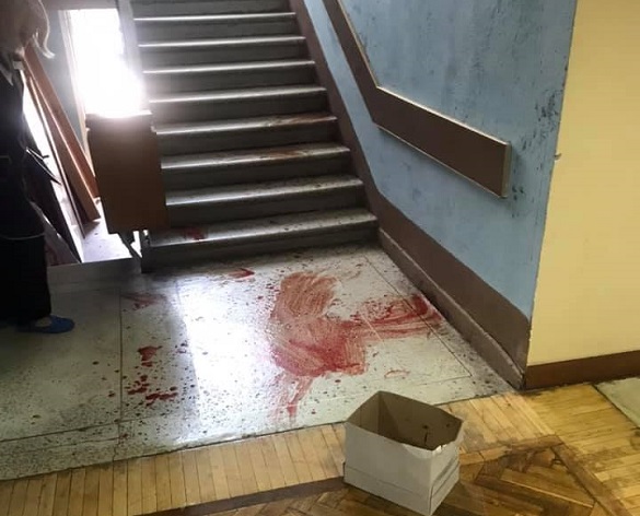 Депутата міської ради у Черкасах облили кров'ю