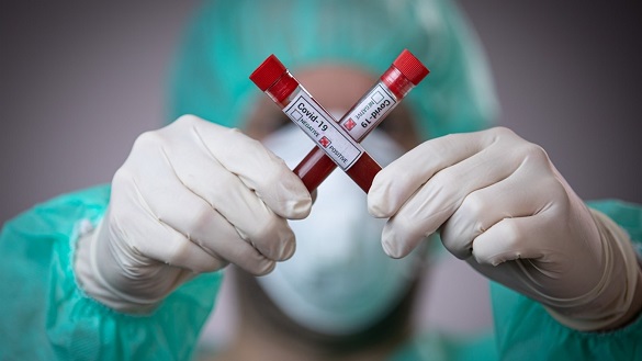 На Черкащині зафіксували 72 нові випадки коронавірусної інфекції