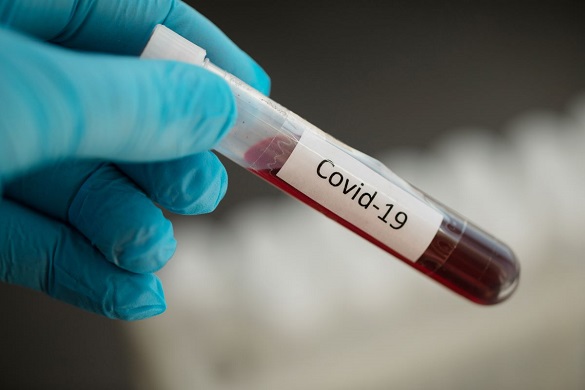 Черкаську область перевірятимуть щодо дотримання правил лікування коронавірусної хвороби