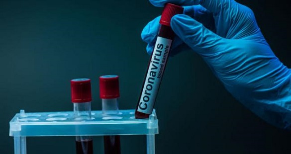 За останню добу на Черкащині померло дві людини, які хворіли на коронавірус