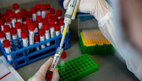 Більше сотні за добу: на Черкащині зафіксували нові випадки захворюваності на коронавірус