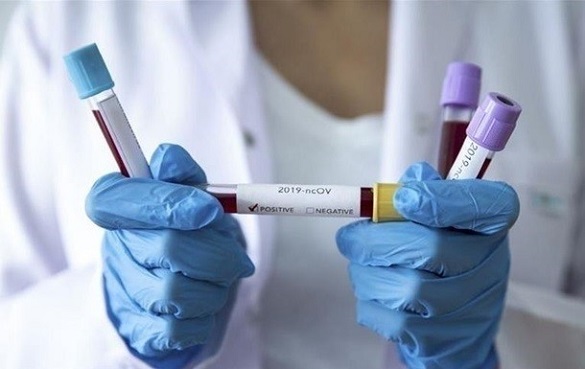 У 15 лікарнях Черкащини лікують хворих на коронавірус