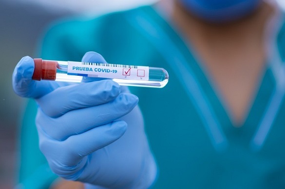 Знову понад сотня: на Черкащині зафіксували нові випадки захворюваності на коронавірус