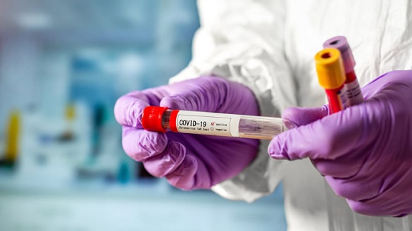 Понад 350 нових випадків коронавірусу зафіксували в Черкаській області