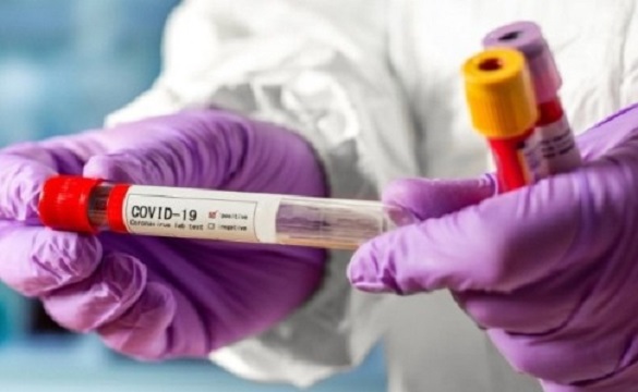 На Черкащині за останню добу зафіксували понад 500 нових випадків COVID-19