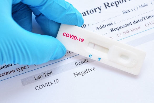 + 239: На Черкащині фіксують зниження рівня захворюваності на коронавірус