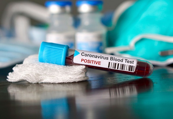 + 233: на Черкащині зафіксували нові випадки інфікування коронавірусом