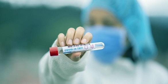 У Черкаській області одна із найбільших кількість підтверджених випадків коронавірусу за добу в Україні
