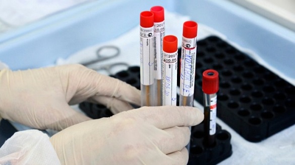 За добу на Черкащині виявили майже сто нових випадків коронавірусу