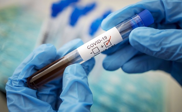 На Черкащині зафіксували понад 240 нових випадків інфікування COVID-19