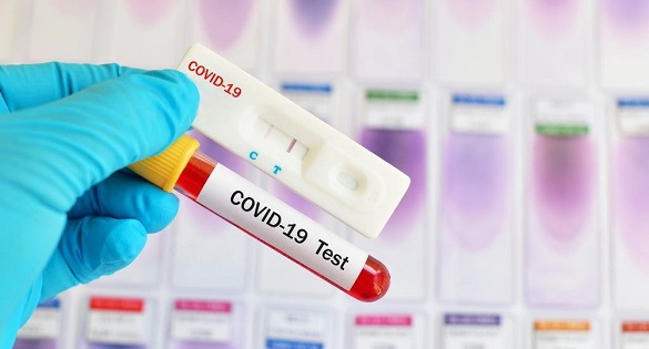 Призовники на Черкащині мають здавати тест на коронавірус 