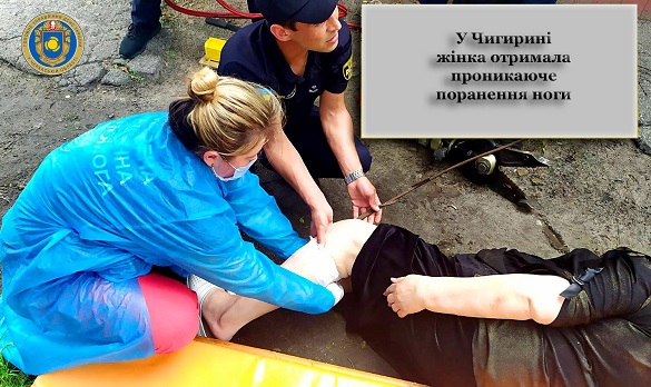 У Черкаській області допомогли жінці, яка поранила ногу