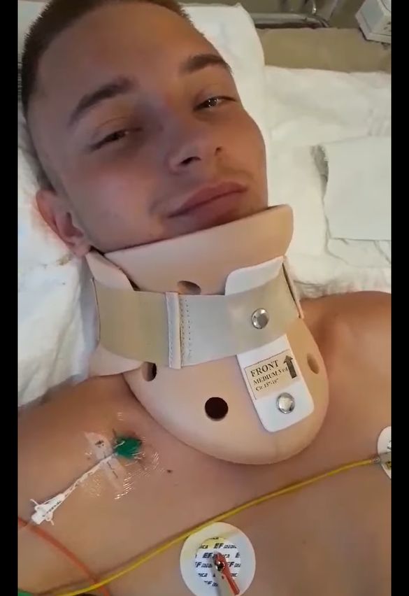 Хлопець, який зламав хребет на черкаському пляжі, потребує операції