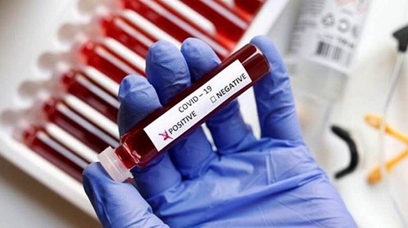 У Черкаській області виявили ще 24 випадки коронавірусу