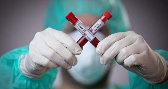 +274 за добу: у Черкаській області зафіксували нові випадки коронавірусу