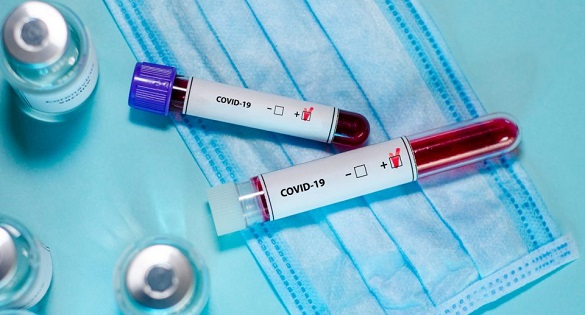 У Черкаській області від ускладнень коронавірусу померли 37 людей