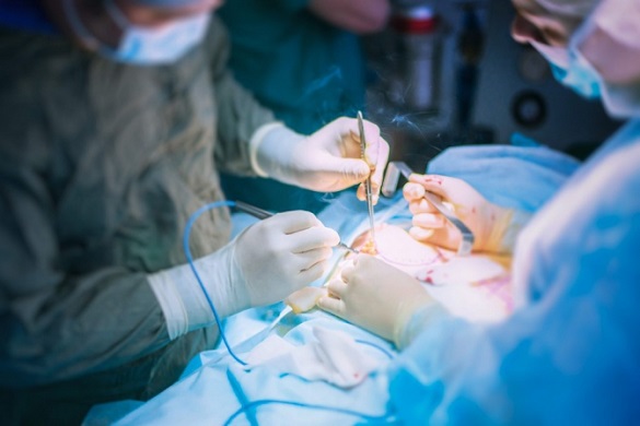 Врятували три життя: у Черкаській обласній лікарні вперше провели забір донорських органів