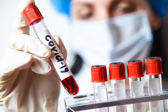 За добу на Черкащині виявили 292 випадки захворювання на коронавірус