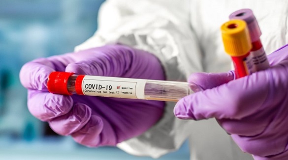 Ще понад 200 нових випадків COVID-19 зафіксували на Черкащині
