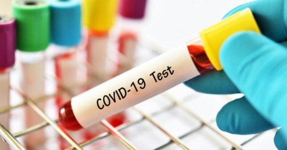 На Черкащині зареєстрували ще понад 100 нових випадків COVID-19
