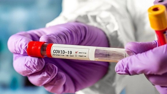 У працівників одного з черкаських комунальних підприємств виявили коронавірус