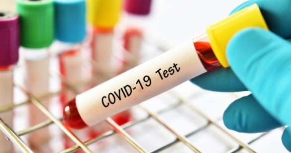 Понад 800 нових випадків COVID-19 виявили на Черкащині