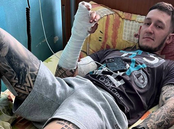 Отримав поранення в Бахмуті: черкаському захиснику потрібні гроші на реабілітацію