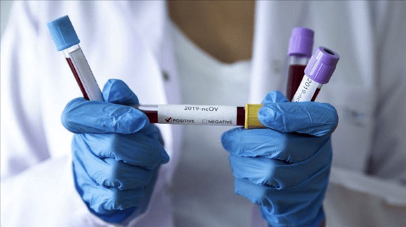 Понад 300 черкащан захворіли на коронавірус за тиждень