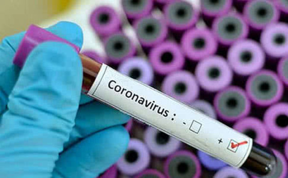 У Черкаській області зареєстрували летальний випадок від коронавірусу